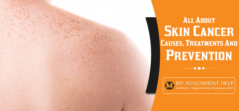 Skin Cancer: Causes, Treatments and Prevention